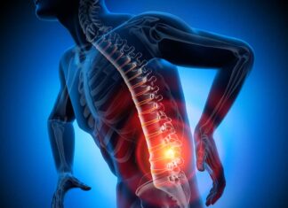 RUGPIJN? Chiropractie brengt verlichting Van Koert Chiropractie - Fotografie iStockphoto