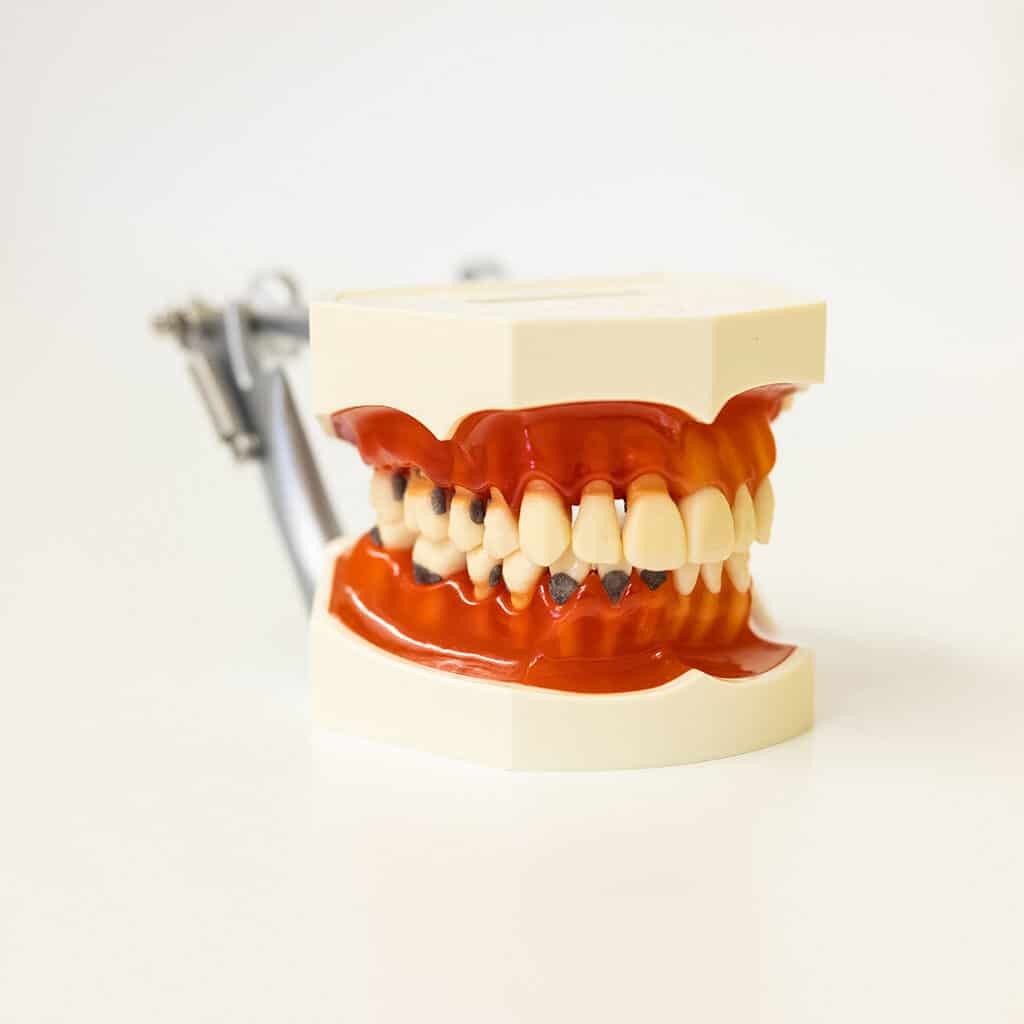 Praktijk voor Orale Implantologie en Algemene Tandheelkunde - Fotografie Marc de Jong