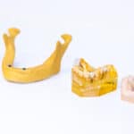Praktijk voor Orale Implantologie en Algemene Tandheelkunde – Fotografie Marc de Jong
