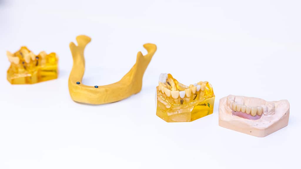 Praktijk voor Orale Implantologie en Algemene Tandheelkunde - Fotografie Marc de Jong